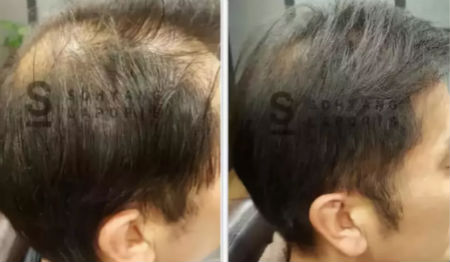 唯拾壹跨境美妝|我缺的不是卷發棒！不是錢！是頭發啊