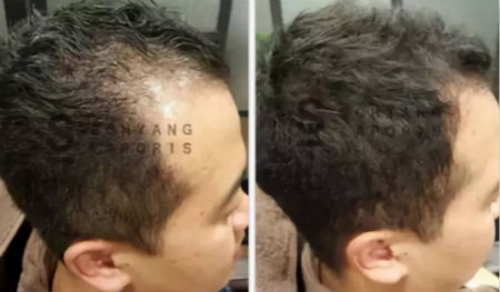 唯拾壹跨境美妝|我缺的不是卷發棒！不是錢！是頭發啊