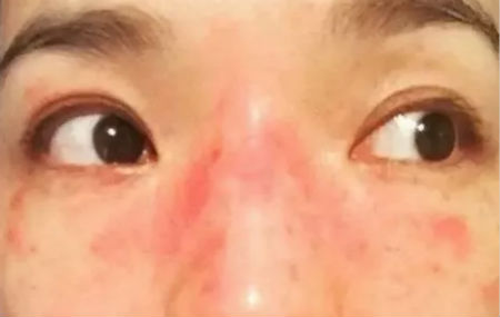 NEWNEW DIY|韓國美容效果那么好，原來是她們在術(shù)后用了這個