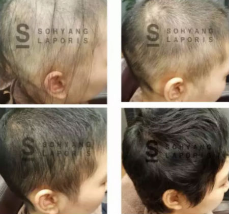 唯拾壹|別人脫單你脫發？樣的頭皮管理能讓你分分鐘開掛！