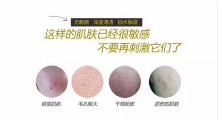 NewNewDIY|敏感肌如何選洗面奶？皮膚科醫生推薦這款！