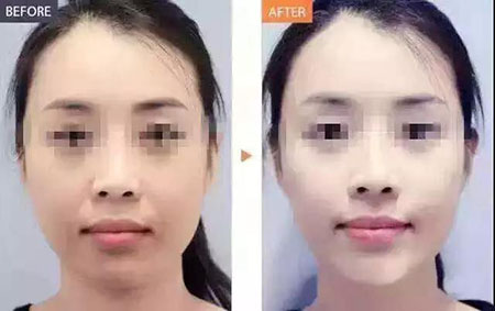 還在靠敷面膜補水？那你的皮膚肯定出問題！