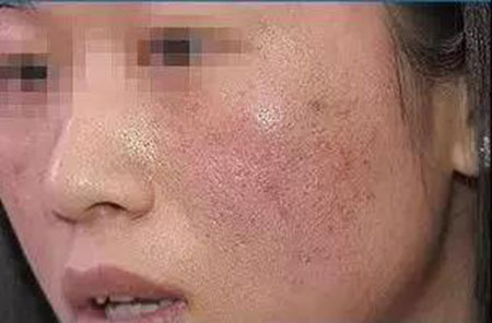 還在靠敷面膜補水？那你的皮膚肯定出問題！