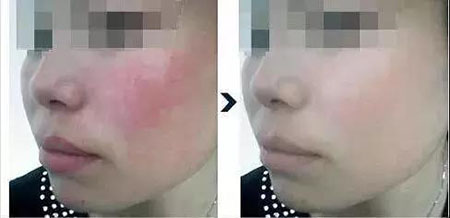 還在靠敷面膜補水？那你的皮膚肯定出問題！