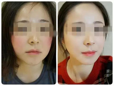 拒絕春季過敏、紅腫、發癢！敏感肌的救星來啦~