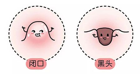 “閉口”這個磨人的小妖精又出來作妖啦！