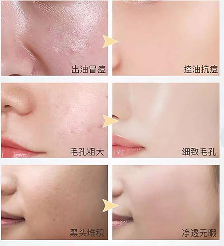 韓詩(shī)緹教你正確洗臉，現(xiàn)在！立刻！馬上！改善皮膚問(wèn)題