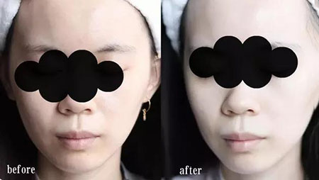 女人總愛摸這里，難怪會毀容，99%的人都中招！