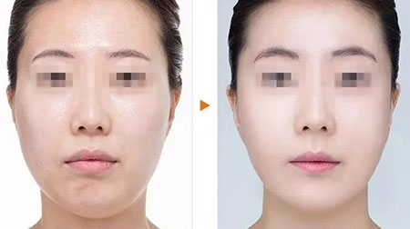 水氧活膚—“氧”出好氣色,打造人見人愛的水嫩美肌~