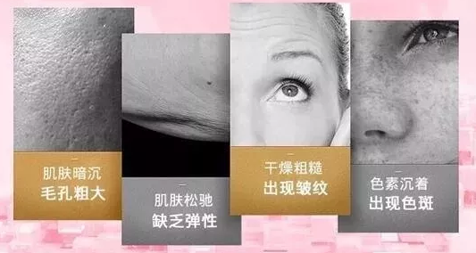 皮膚粗大還有救嗎?VN智能光電美膚讓你的肌膚不在“孔”慌