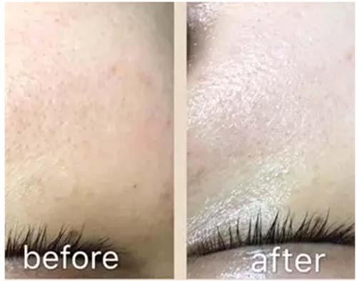 水光嫩膚管理深度補(bǔ)水、鎖水保濕