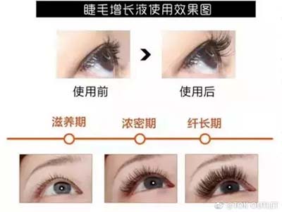 iGLORY睫毛增長(zhǎng)液