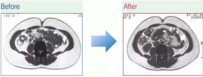 高周頻溶脂塑身管理