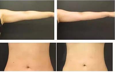 操作30分鐘，腰圍減少3-6公分”這種健康美容瘦身的方法你知道嗎