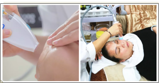 VN美膚經:定期做皮膚管理的好處,值得每個人收藏!