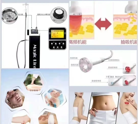 VN身體管理：告別虛胖！不用節食！燃脂塑形躺著就瘦