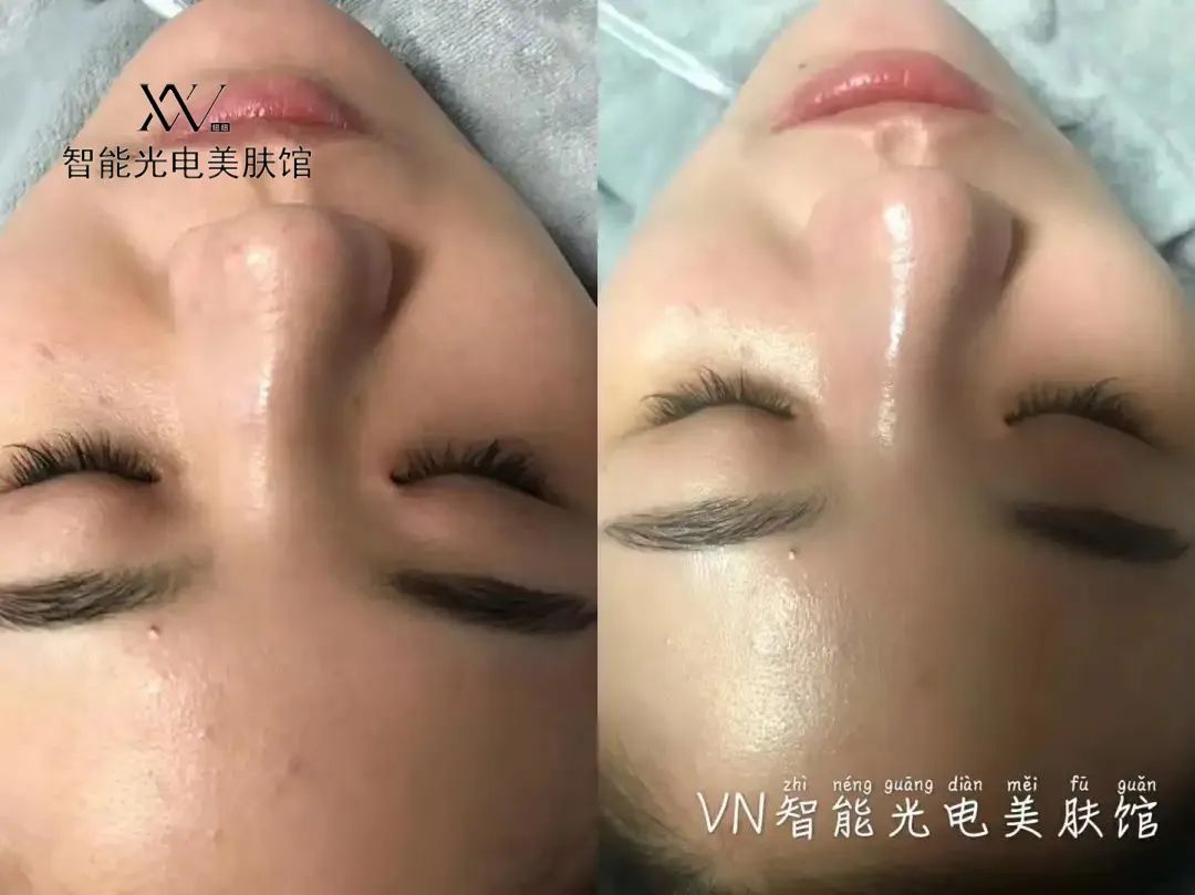 VN美業運營：掌握這5種需求，顧客追著你買單！