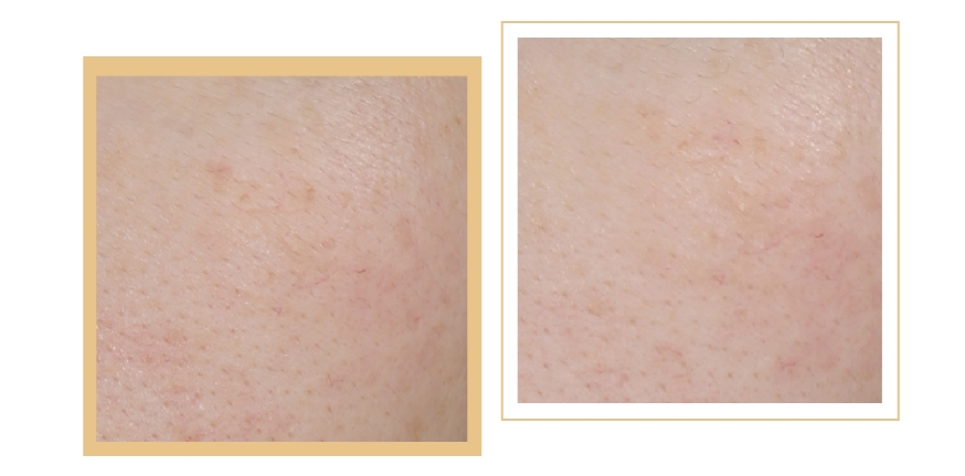 燕麥多糖抗皺乳液 | 抵御衰老侵襲，向時(shí)光開戰(zhàn)