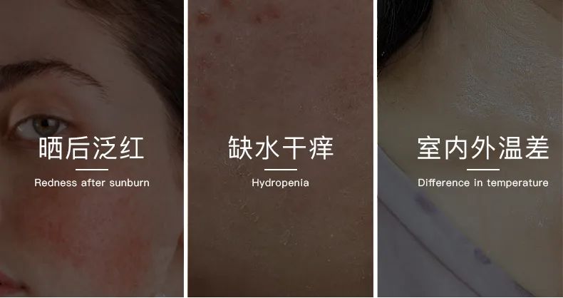 無懼時光，天生優雅，敏感肌&受損肌的修護“膜”法